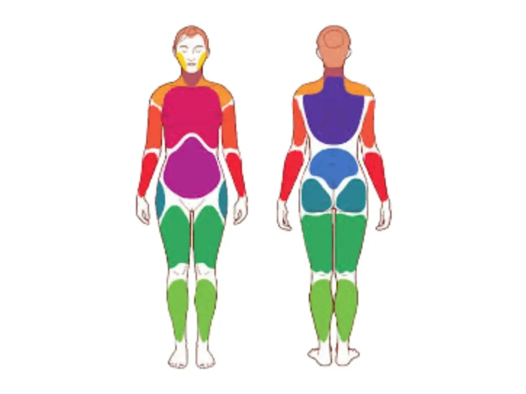 Criterios ACR 2010 fibromialgia índice dolor generalizado WPI 19 regiones corporales diagnóstico