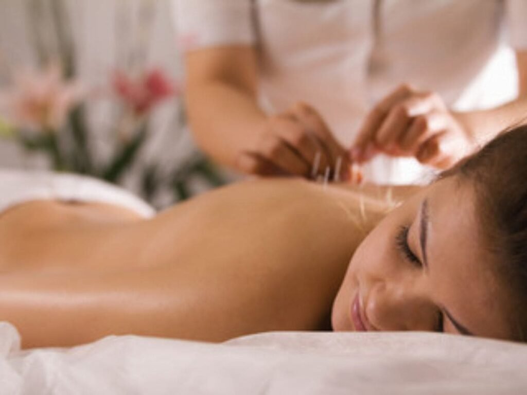 acupuntura y fibromialgia