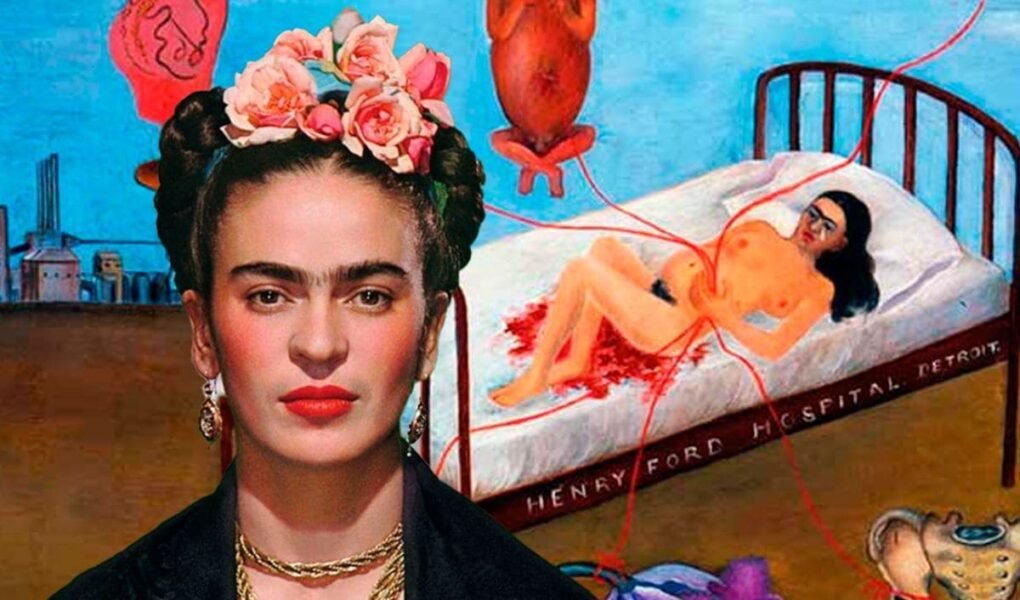 Frida Kahlo fibromialgia